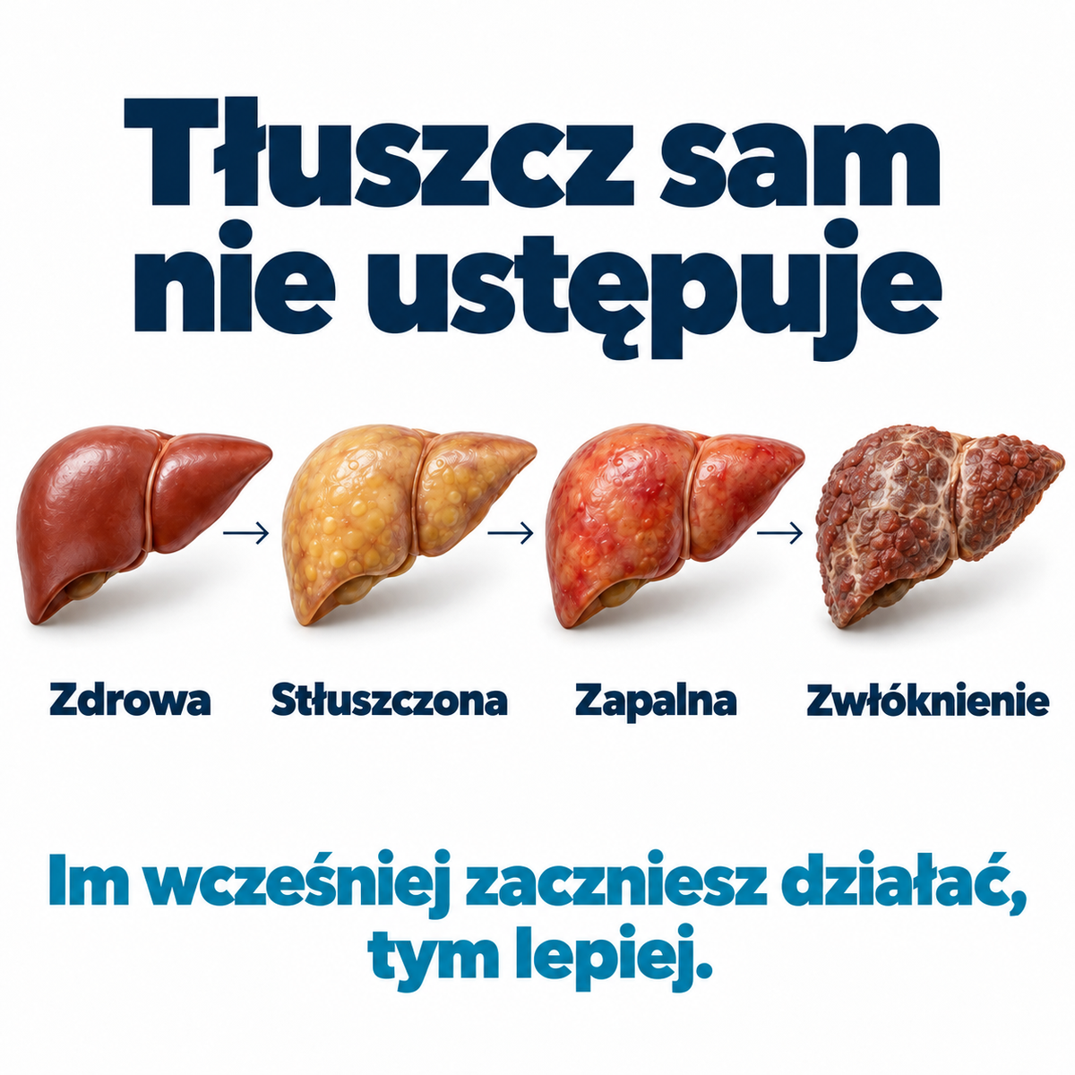 Tłuszcz sam nie ustępuje