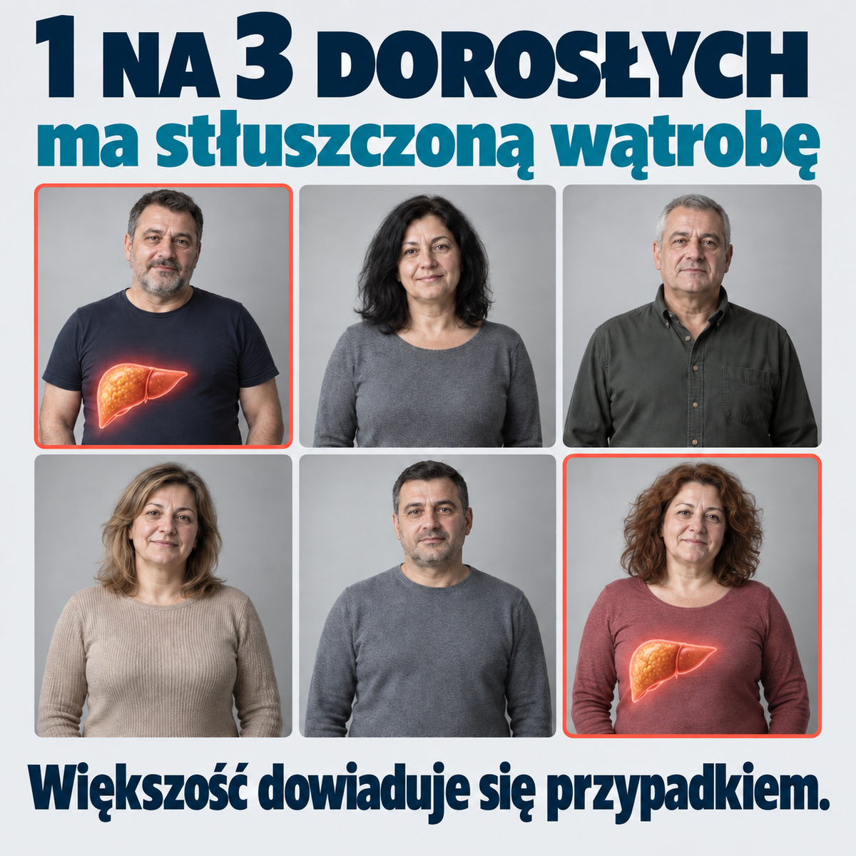 1 na 3 dorosłych ma stłuszczoną wątrobę